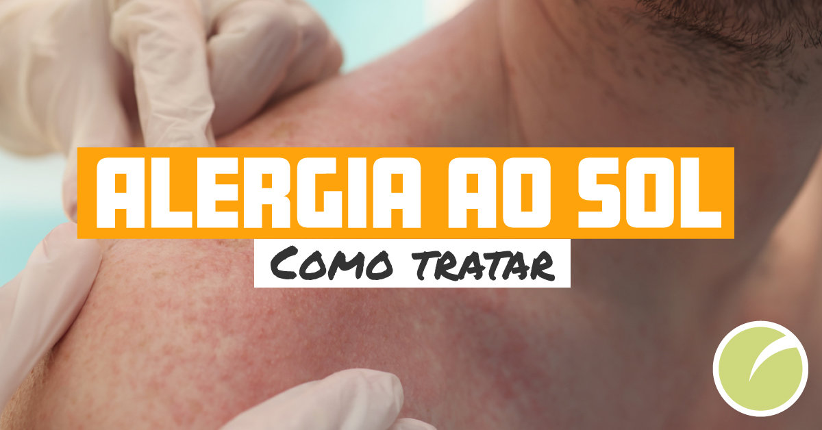 Como tratar as alergias ao sol: cuidados | DECO PROteste