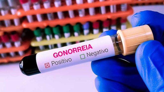 tubo de análise para despiste de gonorreia