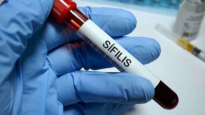 Tubo com sangue para análise à sífilis