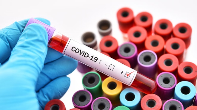 Vista de cima de um conjunto de tubos de ensaio, dos quais só são visíveis as tampas, muito coloridas. Em primeiro plano, à frente deste conjunto de tubos, vista parcial de uma mão enluvada segurando um destes tubos de ensaio, cheio de um líquido vermelho, cujo rótulo contém a inscrição "COVID-19", bem como duas checkboxes - uma das quais está assinalada com um visto.