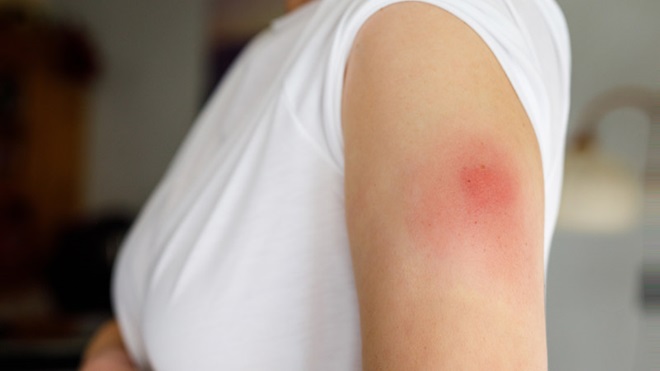 efeitos secundarios vacina