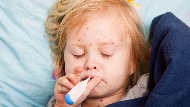 criança com sarampo e com termómetro