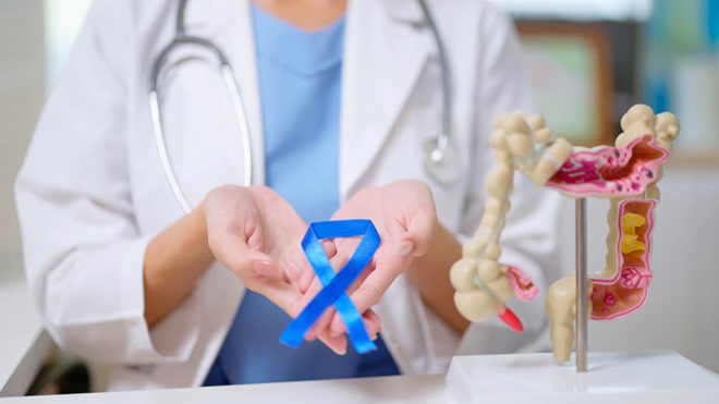 cancro colorretal