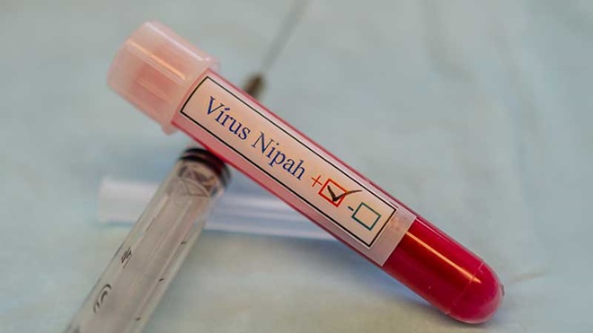 Tubo de sangue para análise com a inscrição "Vírus Nipah"