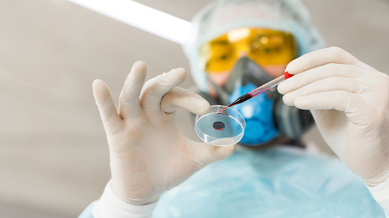 Investigador visto de baixo em laboratório com equipamento de proteção a colocar uma amostra de sangue num prato Petri 