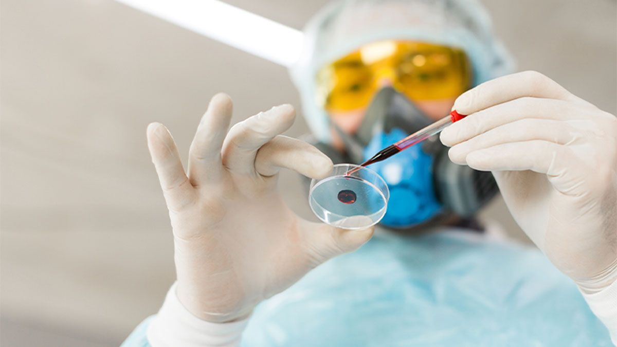 Investigador visto de baixo em laboratório com equipamento de proteção a colocar uma amostra de sangue num prato Petri 