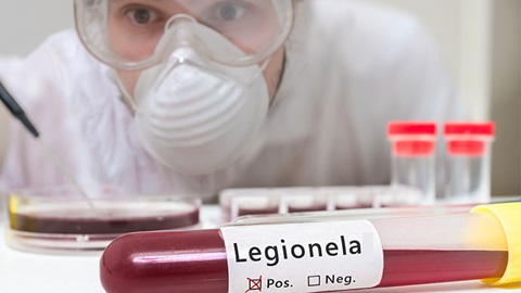 analista em laboratório com amostra de sangue para detetar legionela