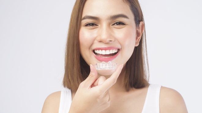 Mulher morena e sorridente a colocar um aparelho dentário invisiível